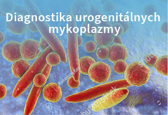 Diagnostika urogenitálnych mykoplazmy